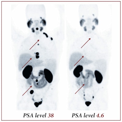 Image courtesy of SNMMI.