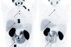 2015 06 10 09 26 49 636 Snmmi Image Of The Year 200