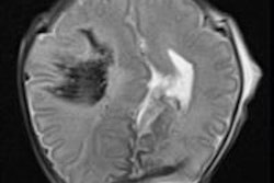 2015 06 17 13 42 11 973 2015 06 18 Postmortem Mri Pic1 20150617204901