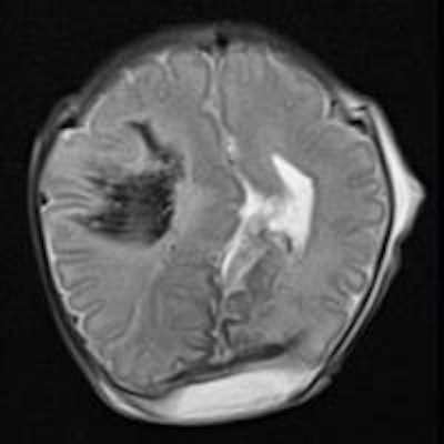 2015 06 17 13 42 11 973 2015 06 18 Postmortem Mri Pic1 20150617204901