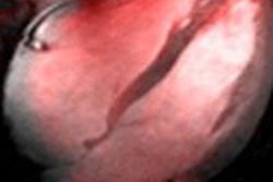 2015 06 19 12 21 26 303 2015 06 18 Sodium Mri Of The Heart At 7 T Niendorf 20150619192303