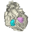 2015 06 26 13 27 18 407 2015 06 26 3 D Heartmodel 200