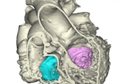 2015 06 26 13 27 18 407 2015 06 26 3 D Heartmodel 200