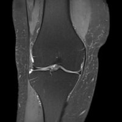 2014 07 30 12 31 33 80 2014 07 31 Knee Mri Thumbnail