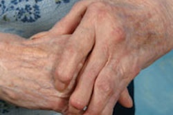 2015 07 01 10 19 51 389 Arthritis Hands 200