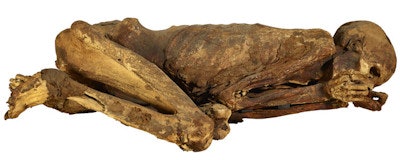 This mummified man was buried in a crouching position around 3,500 B.C. in Egypt and was discovered in 1896. Thought to be between 18 and 21 years old when he suffered a violent death, he was wrapped in linen and matting and placed in a shallow grave. He was stabbed in the back by a weapon. All images of mummies courtesy of Trustees of the British Museum.