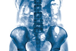2015 07 27 11 44 55 160 X Ray Abdomen