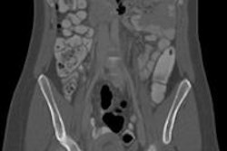 2015 07 31 15 16 28 864 2015 08 03 Ct Pregnancy Crohns 20150731221650