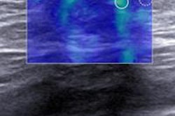 2015 08 05 16 40 44 250 2015 08 06 Tnbc 20150805234317