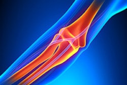 2015 08 07 11 44 26 938 Elbow Joint 200