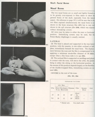 Fig 3. Radiography of the nose from Positioning in Radiography.