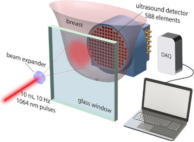 The breast is positioned pendant through an aperture and compressed cranio-caudally between the ultrasound detector and a glass window. The laser is fired through the window and expanded to a diameter of around 70 mm to illuminate the breast. Credit: Scientific Reports.