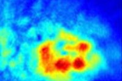 2015 09 03 11 24 21 278 2015 09 04 Medphysweb Heijblom Fig1 20150903183118