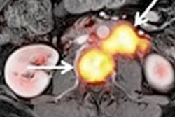 2015 09 03 19 19 15 584 Grueneisen Clinical Image 450 20150904022927