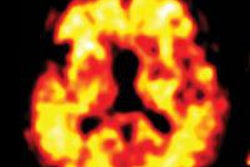 2015 09 09 12 26 54 625 2015 09 10 Lancet Image 10sept15 800 20150909192715