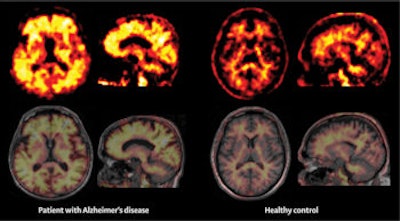 2015 09 09 12 26 55 259 2015 09 10 Lancet Image 10sept15 350