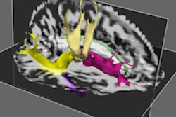 2015 09 16 17 16 29 824 Dti Mri Carnevale 200