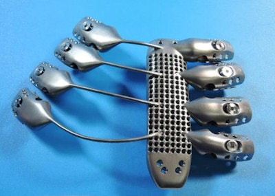 Front of 3D-printed titanium sternum and ribs. Image courtesy of CSIRO, Clayton, Australia.