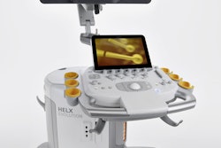 2015 09 24 09 28 15 419 Siemens Helx 250