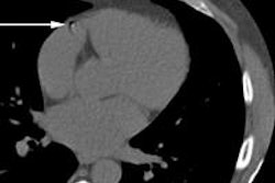 2015 09 28 12 16 09 777 2015 09 Wolterink Auto Calcification A 20150928192057