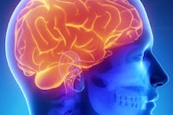 2014 07 18 14 26 51 127 Brain General 200