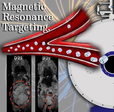 Using MR scanners to steer cancer-killing cells to tumors in mice significantly delayed tumor growth compared with a control group.