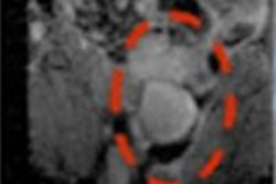 2015 10 01 12 08 55 109 2015 10 02 Medphysweb Mrt 20151001191024