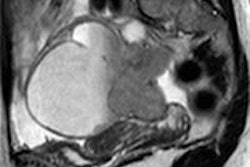 2015 10 15 16 02 46 82 2015 10 16 Gynecologic Figure1 20151015231251