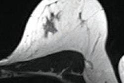 2015 10 21 09 36 38 518 2015 10 21 Jfr Breast Image1 20151021164111