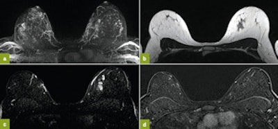 2015 10 21 09 36 38 524 2015 10 21 Jfr Breast Image1 350