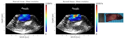 2015 10 26 12 59 51 335 2015 10 27 Medphysweb Cardiac Swe Fig5b 800