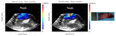 2015 10 26 12 59 51 778 2015 10 27 Medphysweb Cardiac Swe Fig5b 350