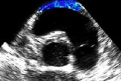 2015 10 26 12 59 52 416 2015 10 27 Medphysweb Cardiac Swe Fig4b 20151026200852