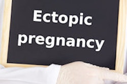 2015 10 28 15 20 21 386 Ectopic Pregnancy 200