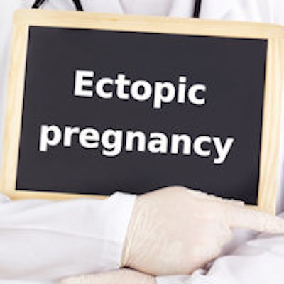 2015 10 28 15 20 21 386 Ectopic Pregnancy 200