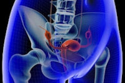 2014 01 15 10 40 30 252 Uterus Pelvic 200