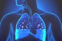 2015 11 02 13 36 09 530 Lung And Body 200