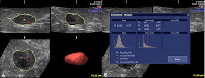 2015 11 04 10 42 22 514 2015 11 04 Turkey Ultrasound 800