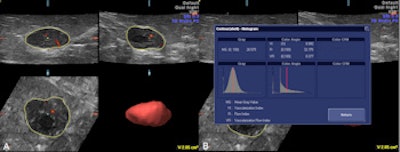 2015 11 04 10 42 22 618 2015 11 04 Turkey Ultrasound 350