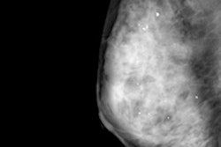 2015 11 05 12 45 35 338 2015 11 05 Lancet Thumb