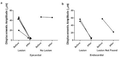 Local harmonic motion amplitudes measured before and after sonication for all epicardial (a) and endocardial (b) in vivo sonications. Reprinted from Ultrasound Med. Biol., Mathew Carias and Kullervo Hynynen ©2015, with permission from Elsevier.