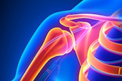 2015 11 18 13 17 07 601 Shoulder Joint 200