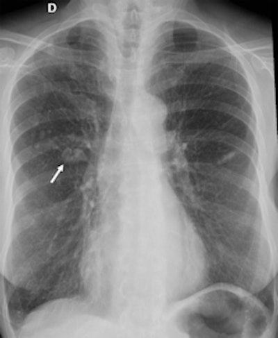 2015 12 07 11 54 01 971 2015 12 07 X Ray Quaia Figure 4a