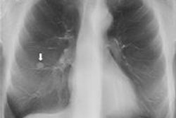 2015 12 07 11 54 02 819 2015 12 07 X Ray Quaia Figure 2b 20151207185430
