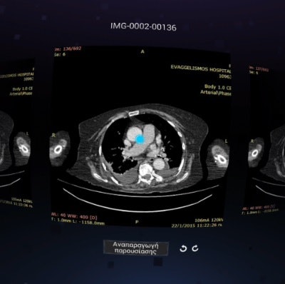 Up to 56 DICOM images can be viewed at one time on the virtual-reality device.
