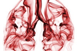2015 12 15 12 11 21 528 Lungs Smoky 200