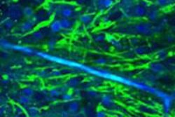 2015 12 23 13 43 00 227 2015 12 Xx Medphysweb Raman Pic1 20151229202050