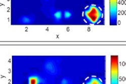 2015 12 30 11 42 32 7 Optical Breast 200