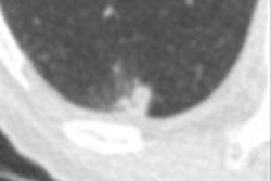 2016 01 06 12 11 53 941 2016 01 07 Followup Colin Jacobs Cad Detected Top 20160106191210