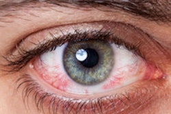 2016 01 08 12 33 03 884 Eye2 200